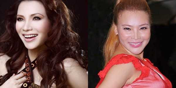 phẫu thuật thẩm mỹ