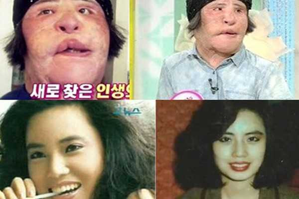 phẫu thuật thẩm mỹ