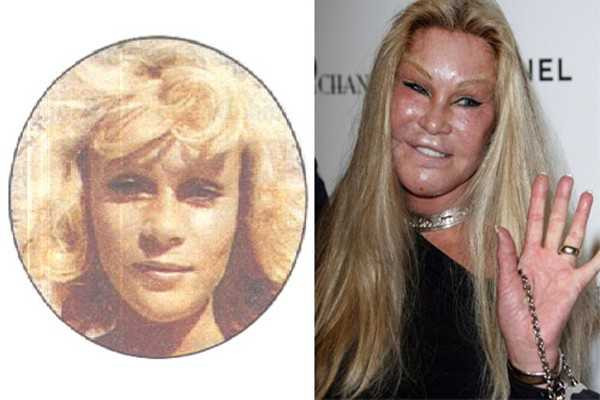 phẫu thuật thẩm mỹ