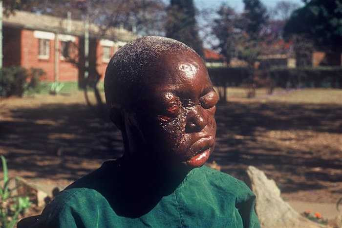 Cho đến nay đã xác định được năm “loài” Ebola, được đặt tên là Bundibugyo, Sudan, Zaire, Tai Forest và Reston. 3 loài đầu tiên đặc biệt nguy hiểm, với tỷ lệ tử vong tới 90%.