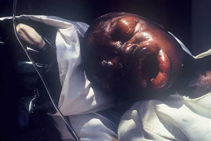 Ebola đang lan truyền với tốc độ chóng mặt tại khắp Tây Phi và khả năng nó vươn tới châu Âu, châu Mỹ và châu Á là hoàn toàn có thể. 