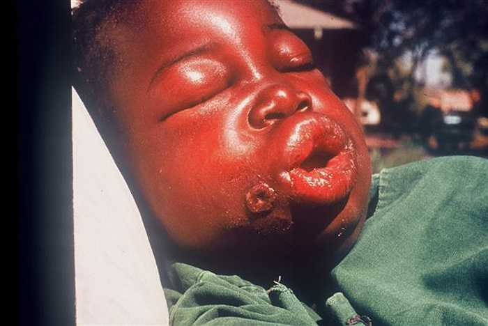 Tại Việt Nam, ngày 1/8, Bộ Y tế đã có công văn khẩn gửi UBND các tỉnh thành cảnh báo về dịch Ebola... 