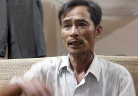 Công an, điều tra, vụ đầu người, chị Huyền, thẩm mỹ, Cát Tường