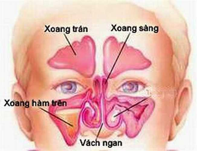 Các bệnh tai mũi họng như viêm xoang, viêm amidan, viêm họng là bạn đồng hành của chứng hôi miệng. Chúng tạo ra nhiều vi khuẩn hơn mức thông thường ở trong miệng khiến cho miệng trở nên nặng mùi. 