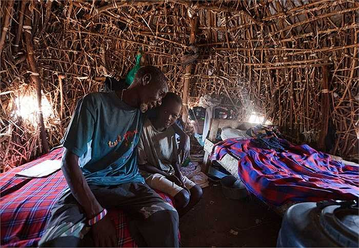 Với chế độ ăn giàu protein, ít rau và thiếu can xi, người El Molo vô cùng nhỏ bé, cấu trúc xương bị biến dạng và trọng lượng cơ thể chỉ nặng từ 30 - 45kg với tuổi thọ chỉ khoảng 45 tuổi.