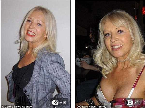 Jane Pesch cho biết bà dành 300 bảng Anh để tiêm botox 2 lần một tháng, 4.000 bảng để phẫu thuật vùng da nhăn ở cổ, Số tiền còn lại dành cho việc nâng ngực và phẫu thuật vùng mặt.