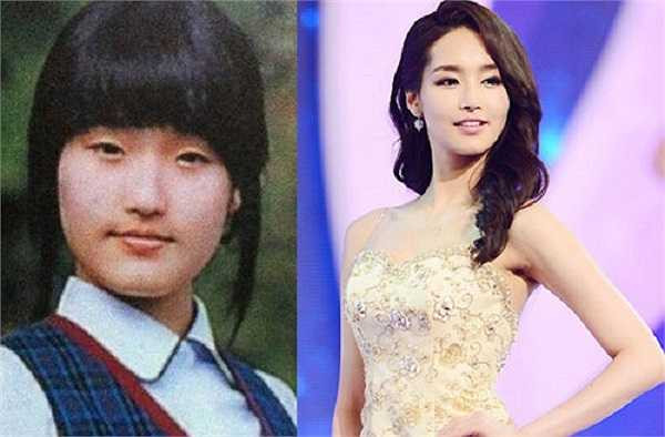 Hoa hậu Hàn Quốc 2012 Kim Yu Mi được mệnh danh là 'Hoa hậu dao kéo xinh nhất'