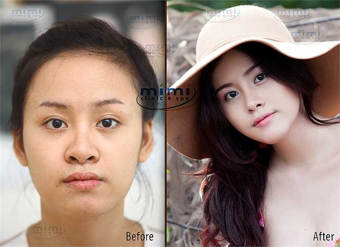 Bà Tưng- cái tên gây sóng gió trong thời gian qua, gần đây đã trở lại với khuôn mặt hoàn hảo hơn nhờ phẫu thuật thẩm mỹ