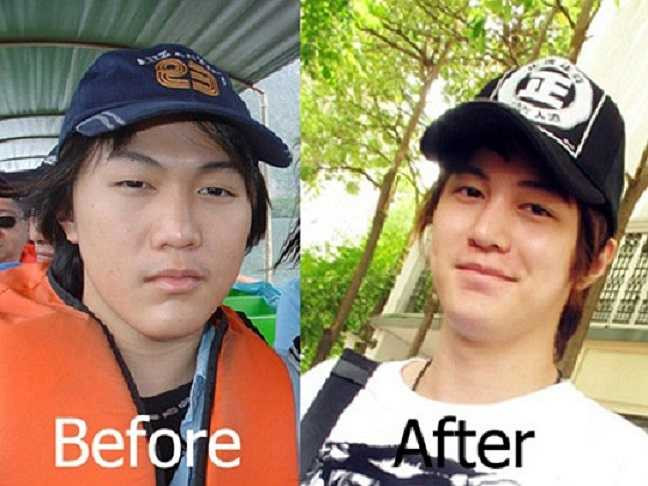 Jose Chung sau 14 lần phẫu thuật thẩm mỹ đã thực sự trở thành anh chàng hotboy hút hồn cư dân mạng