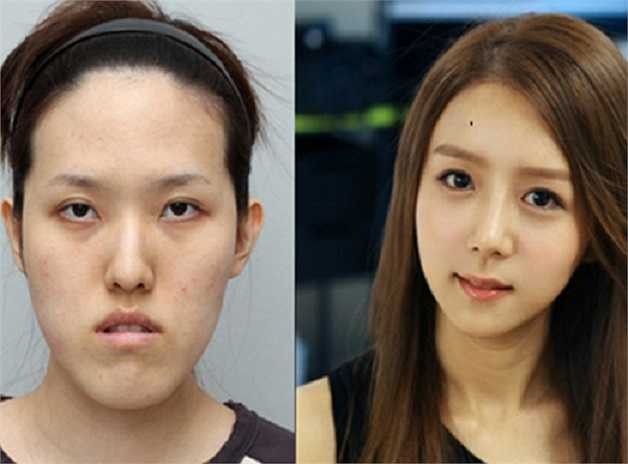 Ở Hàn Quốc, Phẫu thuật thẩm mỹ được coi là sự thay đổi những sai lầm của tạo hóa