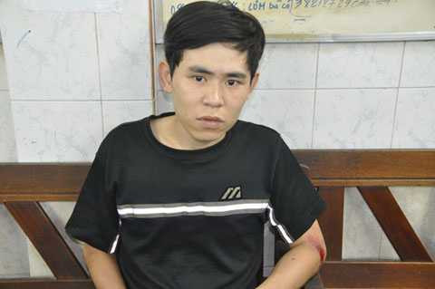 Cảnh sát hình sự, bắn thủng đùi, tên cướp, trên phố, TP HCM