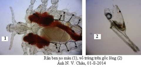Rận bẹn ký sinh ở 'chỗ khó nói'