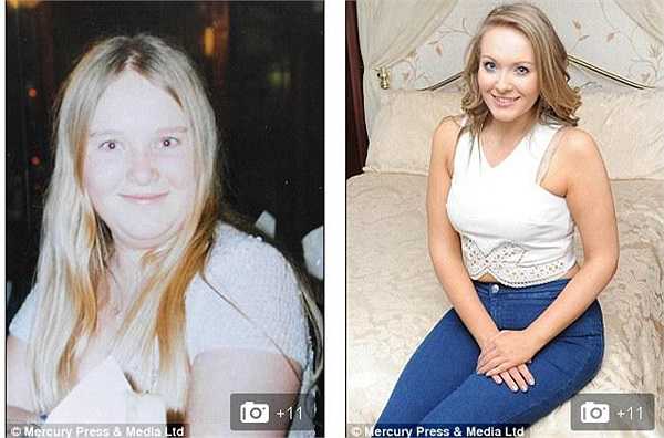 Không chịu khuất phục trước tình trạng của mình, cô gái trẻ quyết tâm giảm cân. 