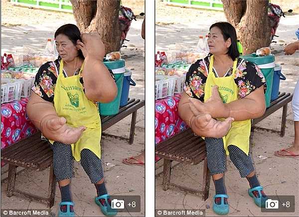 Bác thường trốn trong nhà và ít khi ra ngoài đường, tuy nhiên khi bố mẹ già, bác bắt buộc phải ra phố phụ giúp công việc buôn bán của gia đình.