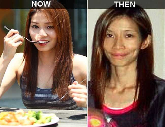 Hình ảnh đối lập giữa hiện tại và trước đây của người mẫu Singapore Angeline Yap Siling.