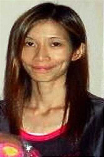 Cuộc đời của Angeline thay đổi khi cô tận mắt chứng kiến cái chết của một cô bạn, người cũng bị chứng biếng ăn.