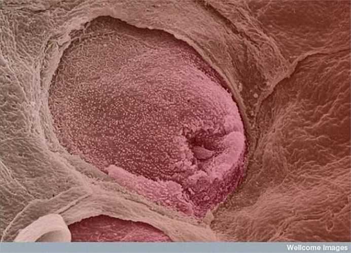 Hình ảnh được tăng cường màu sắc này thể hiện nụ vị giác trên lưỡi. Lưỡi người có khoảng 10.000 nụ vị giác chịu trách nhiệm phát hiện các tín hiệu về vị khác nhau như mặn, cay, đắng, ngọt và ngon.