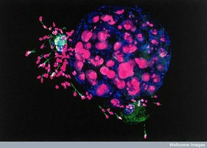 Trông có vẻ như là thế giới đang có chiến tranh vậy, nhưng thực sự đó lại là hình ảnh 5 ngày sau khi trứng được thụ tinh. Một số tế bào tinh trùng còn sót lại vẫn còn bám ở xung quanh. Phôi và các nhân của tế bào tinh trùng có màu hồng sậm trong khi đuôi tinh trùng lại có màu xanh. 