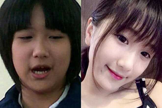 Nhờ giảm cân, nữ sinh Việt từ 'vịt hóa thiên nga'