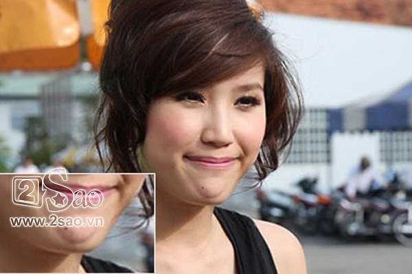 Điểm nghi án nhiều nhất là chiếc cằm kì lạ của cô. 