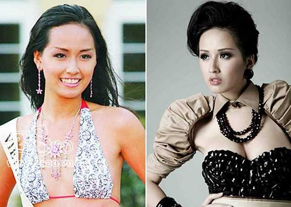 Cô cũng lộ sẹo lồi lõm ở phần dưới cánh tay. 