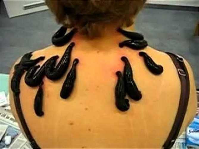 Đỉa bơi rất khỏe, khi bám vào da của người, hay của động vật, gờ cơ ở khoang miệng sẽ hoạt động như lưỡi cưa và gây nên một vết thương hình hoa thị.