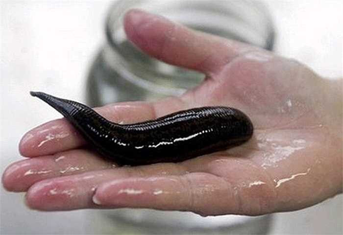 Lớp tế bào biểu bì của loài đỉa luôn tiết ra một chất dịch nhờn làm cho mặt da con đỉa luôn trơn bóng, gây khó bắt.