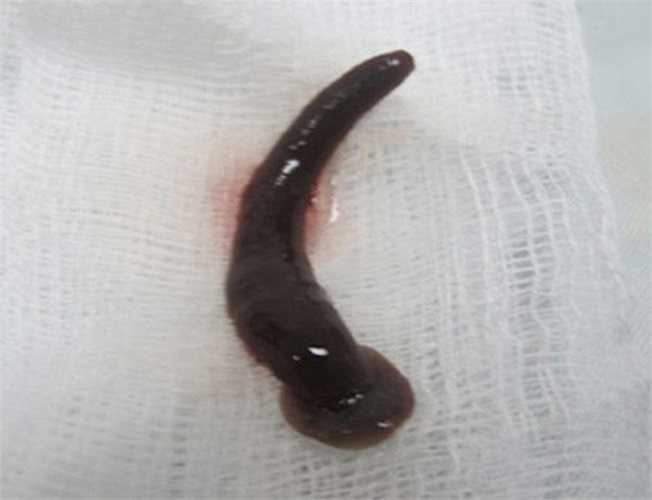 Đỉa sống theo bầy, có khả năng chăm sóc con cái cho đến khi trưởng thành, bảo vệ và di chuyển đỉa con đến những nơi an toàn – những đặc tính vốn chỉ thấy ở động vật có xương sống.