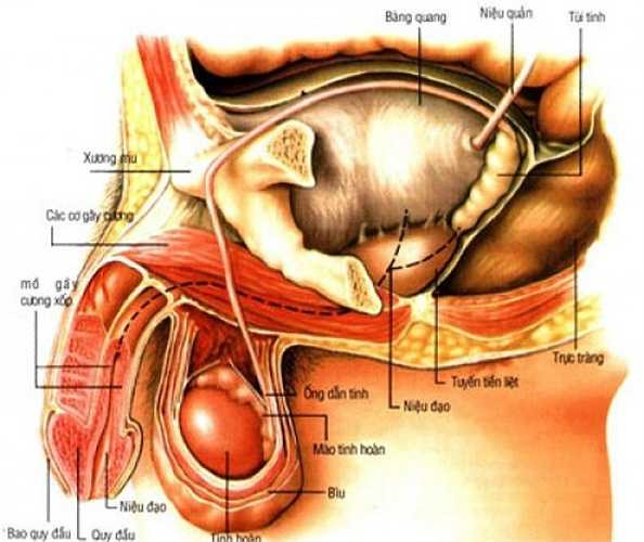 11. Viêm tuyến tiền liệt mạn tính: Có thể gây đau tinh hoàn, biểu hiện là đau một bên tinh hoàn, đau âm ỉ hoặc đau liên tục. Bệnh nhân chủ yếu là thanh niên, hiếm gặp ở người cao tuổi.