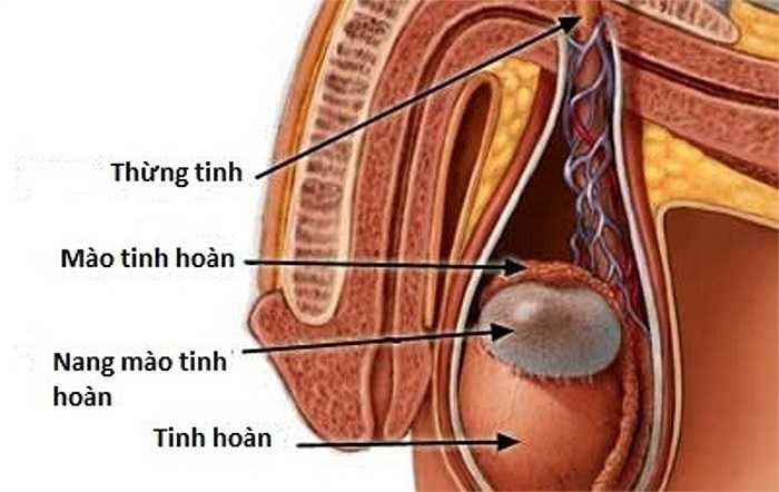 10. Nang mào tinh: Về cơ bản là một u nang phát triển trong ống dẫn tinh trùng. Trong phần lớn các trường hợp nang này là lành tính vì nó được hình thành do sự tích lũy của tinh trùng. Nếu nang mào tinh quá lớn có thể dẫn đến căng tức và gây đau.