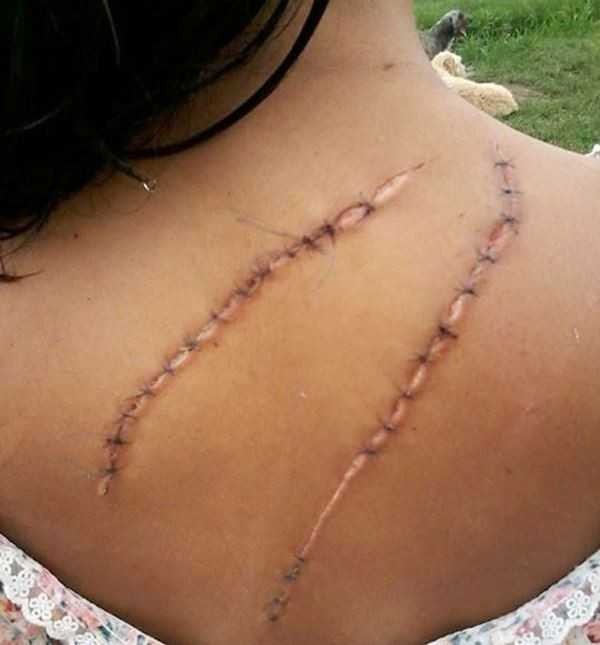 Vì quá xinh đẹp nữ sinh bị tấn công