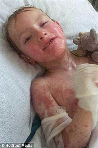 Thậm chí, phụ huynh của Stacey còn được các bác sỹ khuyến cáo rằng con trai họ có thể không qua khỏi trong thời gian ngắn.