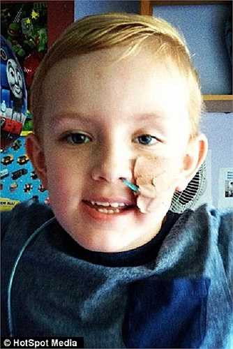 Trước đó, cậu bé tội nghiệp ngụ tại Anh này được cho uống loại thuốc tên Tegretol sau khi lên cơn động kinh. Nhưng chỉ vài ngày sau, cơ thể của em bắt đầu bị dị ứng nặng với loại thuốc này.