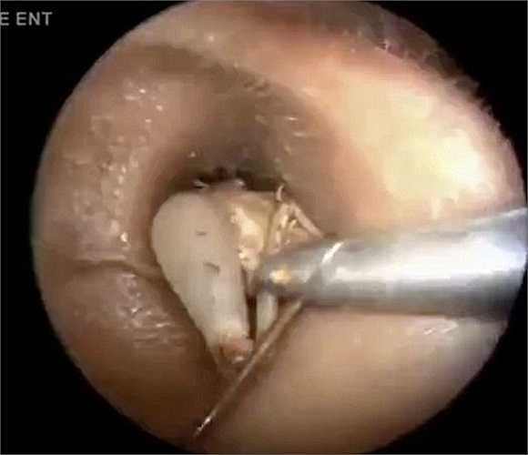 Được biết đây là loài dễ phổ biến trên thế giới và chỉ hoạt động vào ban đêm.