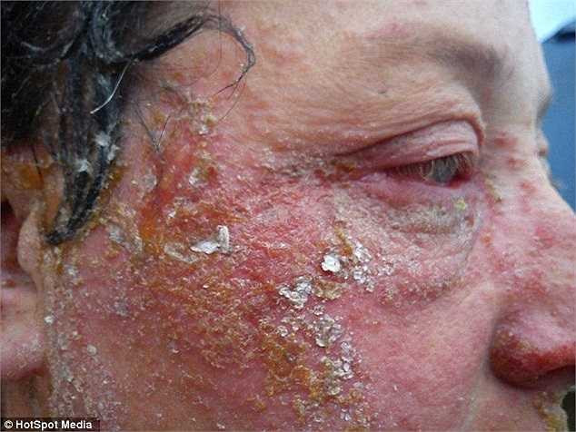 Trước đó, bà mẹ 3 con ngụ tại hạt Kent, Anh đã sử dụng bộ sản phẩm thuốc nhuộm tóc tại nhà Schwarzkopf XXL Live nhằm 'thay đổi mái tóc' của mình.