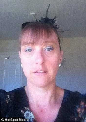 Được biết, người phụ nữ này có thói quen nhuộm tóc từ khi còn thanh niên và cô chưa từng gặp vấn đề gì với thuốc nhuộm tóc trước đó.