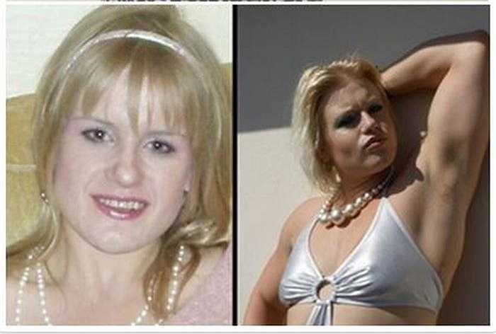 Trước đây, Candice 28 tuổi, London là một cô gái thanh mảnh, đẹp, tóc vàng.