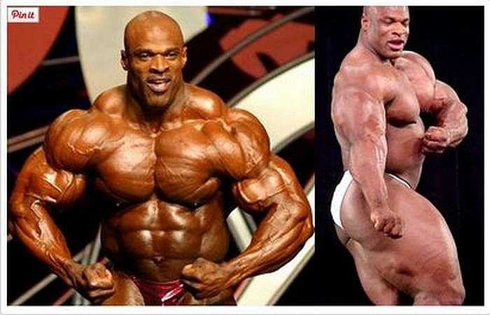 VĐV thể hình Ronnie Coleman Dean, 49 tuổi (Mỹ) bị nữ hóa tuyến vú do sử dụng testosterone. Đây là một dạng ngực phát triển ở đàn ông như lại có kích thước to như của phụ nữ.
