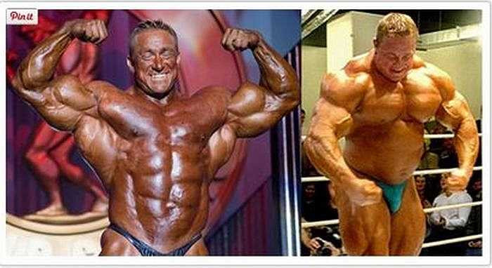 Markus Rühl, 41 tuổi, là một thể hình chuyên nghiệp của Đức đã sử dụng nhiều chất bổ sung khác nhau từ khi 18 tuổi bao gồm insulin và hormone tăng trưởng. Sau đó, ông bị chứng ‘ruột lớn’ – một dạng dạ dày bị căng phồng.