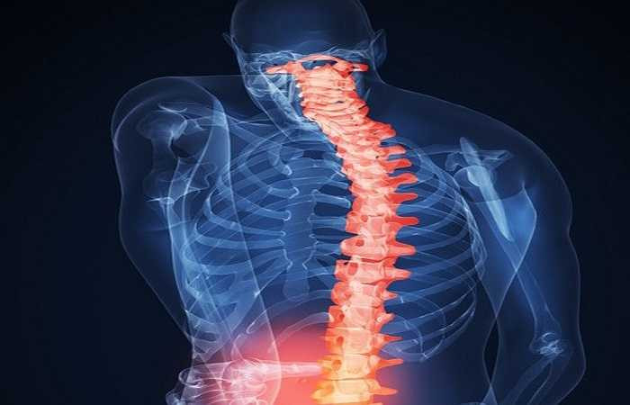 Tổn thương đến cột sống: Việc ngồi máy tính, chơi game kéo dài, dù ở tư thế chuẩn hay sai tư thế, đều để lại hậu quả với cột sống của người chơi như cong vẹo cột sống hoặc thoát vị do ngồi sai tư thế. Hậu quả sẽ là những cơn đau lưng và nhiều chứng bệnh đi kèm.