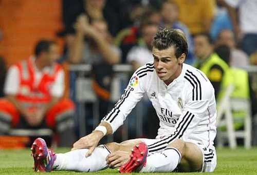 Real 'méo mặt' vì chấn thương của Bale