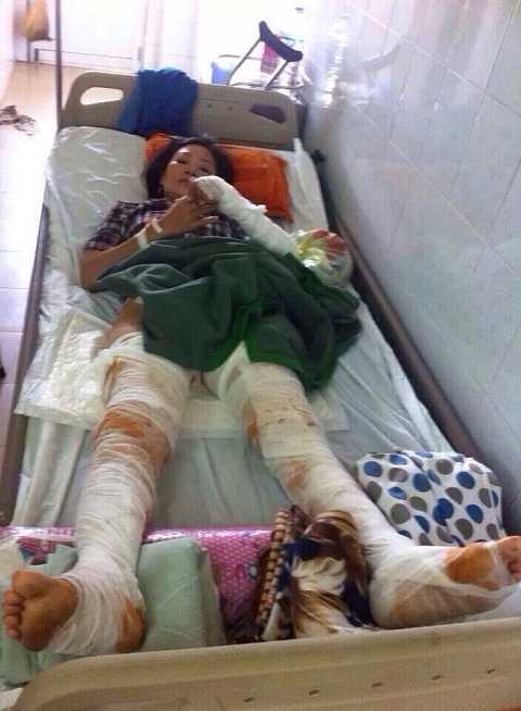 Dùng xăng tẩy vết bẩn, hai vợ chồng và con bị bốc cháy