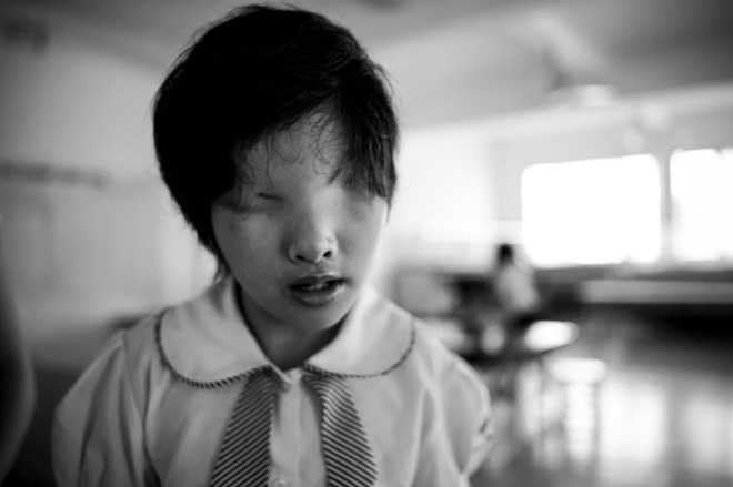 học sinh khiếm thị