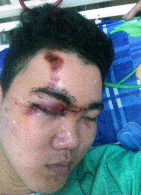 Có hay không nam thanh niên vượt đèn đỏ bị CSCĐ gây thương tích?