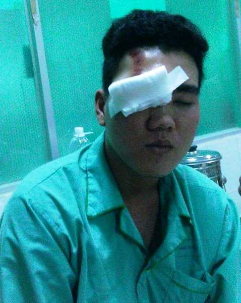 Dân 'tố' CSCĐ vung gậy: Bệnh viện từ chối cấp cứu nạn nhân?