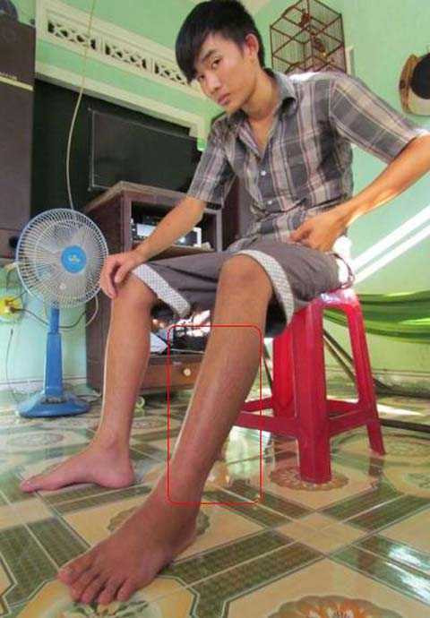 Quảng Ngãi, rắn độc, rắn lục đuôi đỏ, tấn công, người dân, cực độc