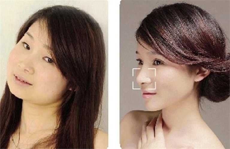 Xu Yan từng phẫu thuật V-line, tạo mũi cao thẳng, tiêm botox để da đẹp hơn. Cô hiện 21 tuổi, làm giáo viên mẫu giáo tại Tuyền Châu. 