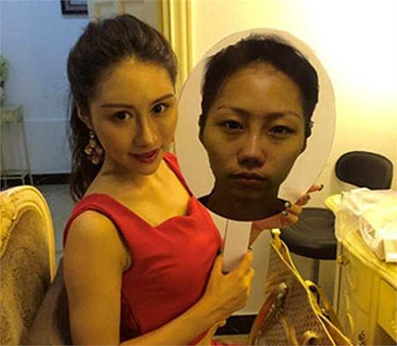 Một cô gái khác cũng đến từ Tuyền Châu - Lin, 19-tuổi từng rất ghét đôi mắt sưng, gò má cao và làn da thô ráp của mình. Do đó, nữ người mẫu đã chỉnh sửa toàn bộ khuôn mặt để có vẻ ngoài như ý.