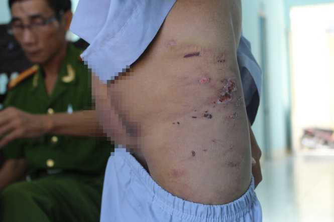 Hai chú tiểu bị hành hạ, đánh đập dã man