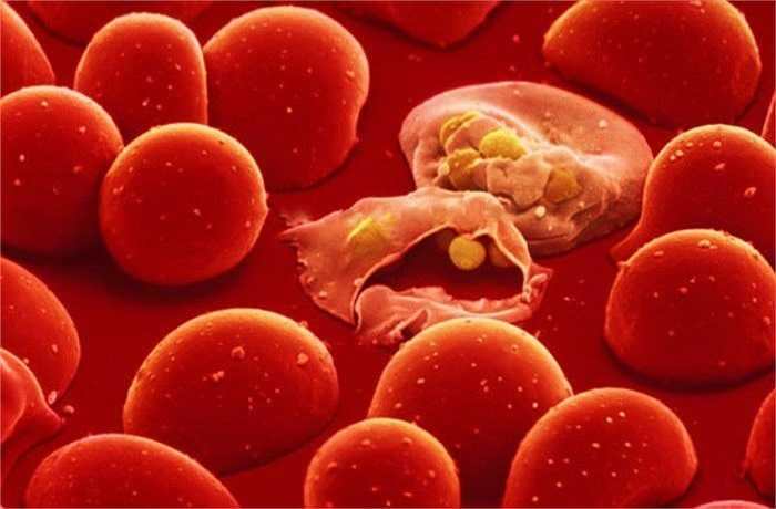 Paraben và Bismuth oxy clorua: Đây là hai thành phần độc hại khác được sử dụng trong son môi. Các tác hại của son môi là do đặc tính gây ung thư của hai thành phần này. Chúng hoạt động như chất bảo quản paraben và cũng giống như formaldehyde. 